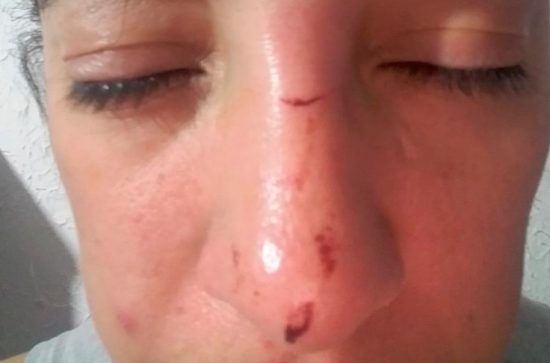 Pessoa em situação de rua dá um soco em moradora e morde policial em Guarapari 1 JenniferSoco