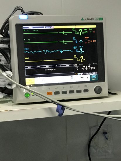 UPA de Guarapari recebe quase R$ 100 mil em novos aparelhos 1 equipamento 1