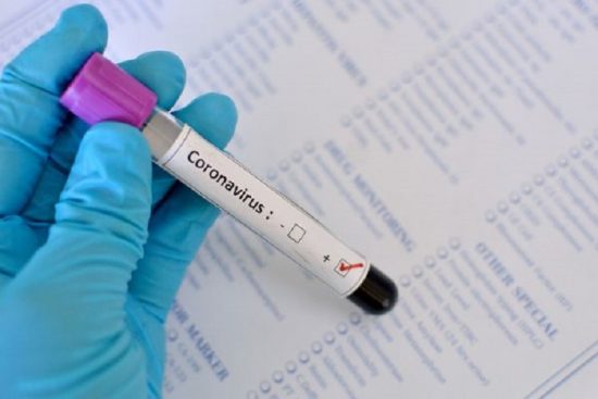 coronavirus foi classificado pela oms como pandemia 205316 article - Guarapari divulga 3ª morte por Coronavírus; ES chegou ao número de 115 óbitos