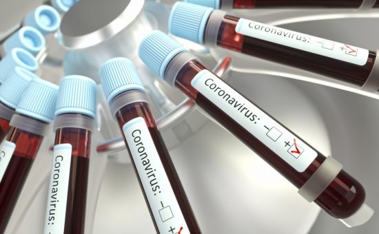 coronavirusteste - Coronavírus: Espírito Santo é referência em transparência nos dados relacionados à pandemia