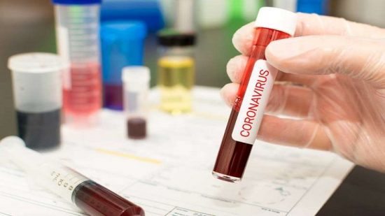 coronavírus - Prefeitura de Guarapari recebe lote de testes rápidos para Covid-19