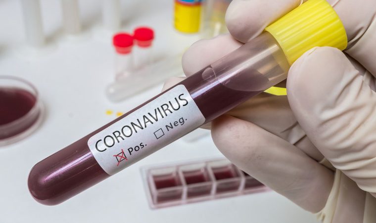 Mais 4 mortes decorrentes do coronavírus são contabilizadas em Guarapari