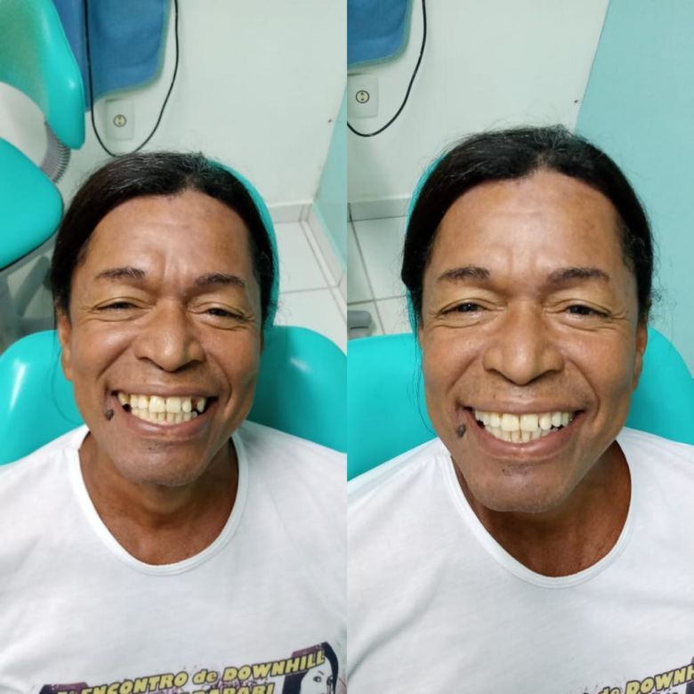 "Docinho" é beneficiado com tratamento dentário em Guarapari