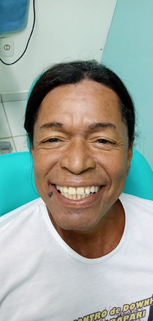 “Docinho” é beneficiado com tratamento dentário em Guarapari