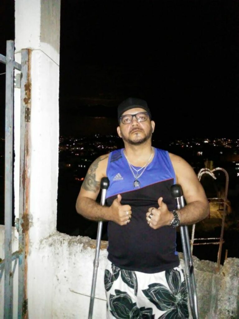 Após sofrer acidente e passar por cirurgias, segurança de Guarapari precisa de cadeira de rodas