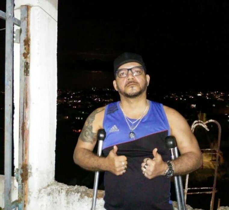 Após sofrer acidente e passar por cirurgias, segurança de Guarapari precisa de cadeira de rodas