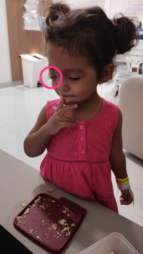 cirurgia Pietra - Em Guarapari, pais agradecem ajuda para cirurgia da filha com tumor no olho