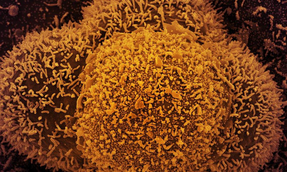 Covid-19: ES confirma primeira pessoa contaminada com a variante Ômicron