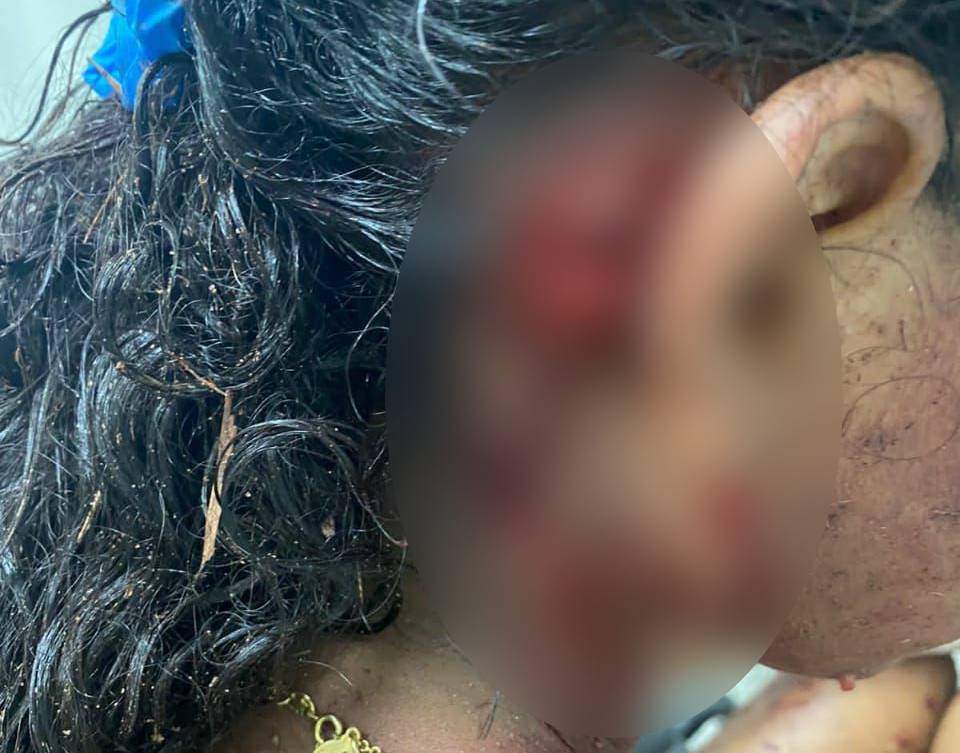 Jovem grávida é atacada por cães em Guarapari