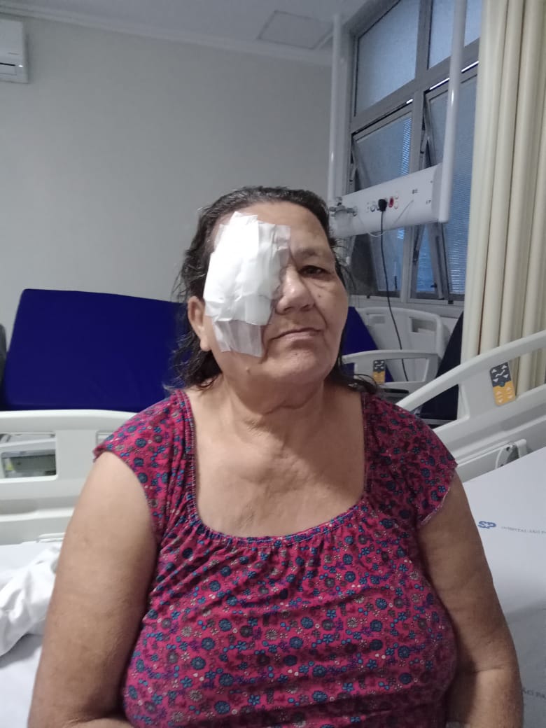 Tumor na órbita ocular: idosa de Guarapari pede ajuda para seguir tratamento em SP após cirurgia