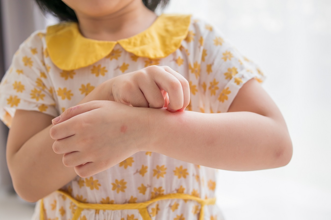 Coluna Papo de Pediatra: Como proteger seu filho contra a dengue