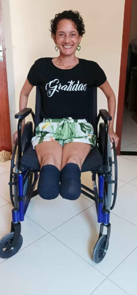 Após amputação das pernas, moradora de Guarapari faz vaquinha para conseguir próteses
