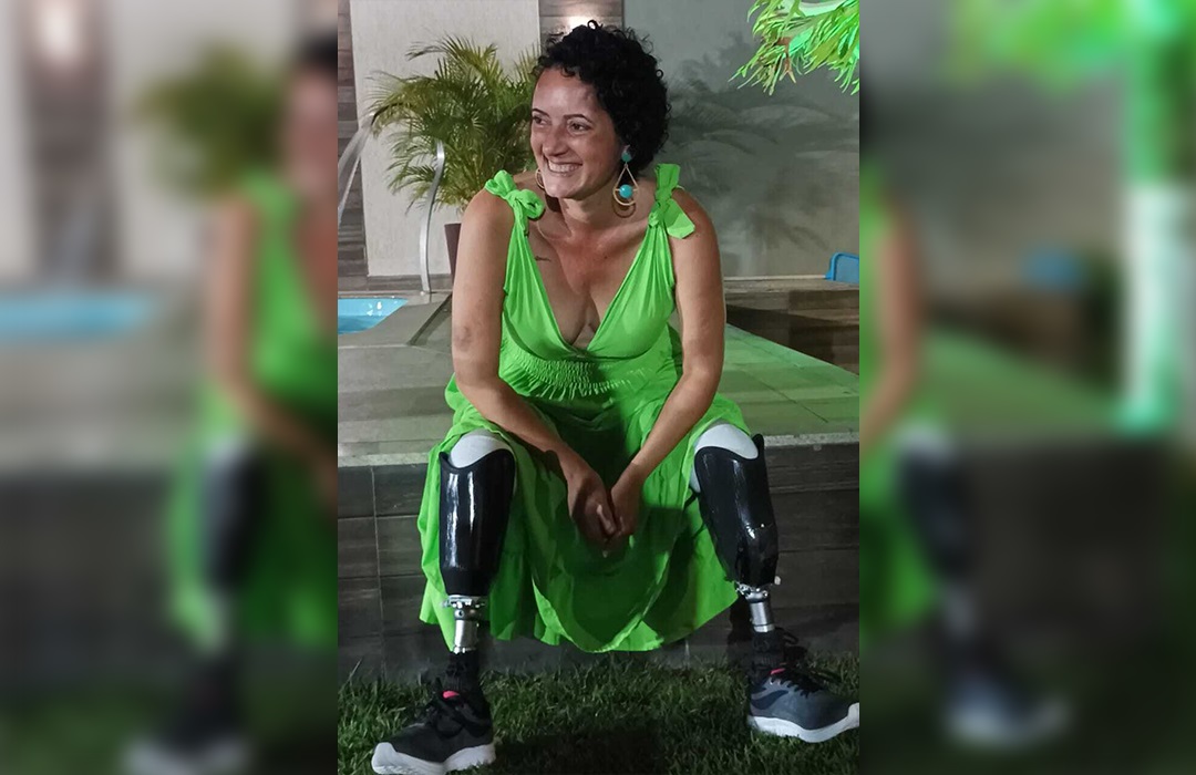 Moradora de Guarapari consegue próteses das pernas com ajuda de vaquinha online