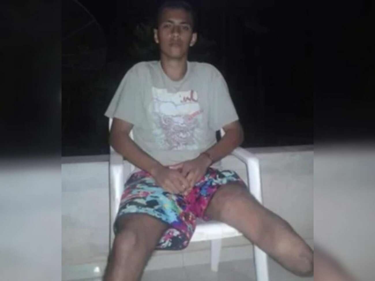 Morador de Guarapari cria vaquinha para conseguir nova prótese para perna 