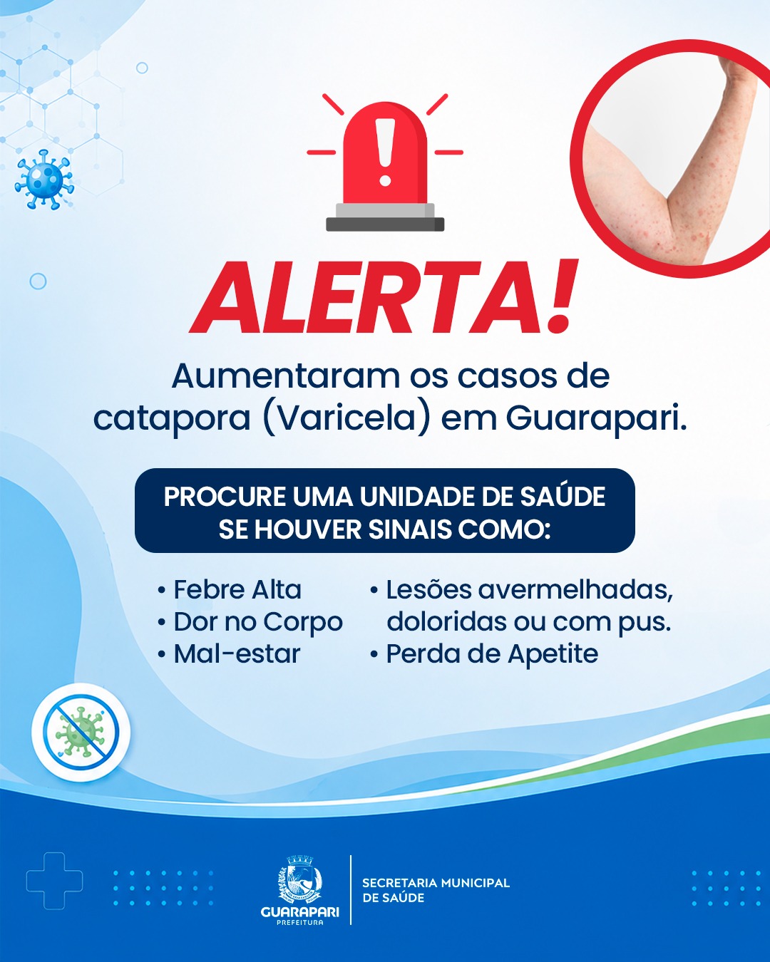 Casos de catapora em Guarapari acendem alerta para ações de prevenção e controle da doença 2 Alerta Catapora PMG 6