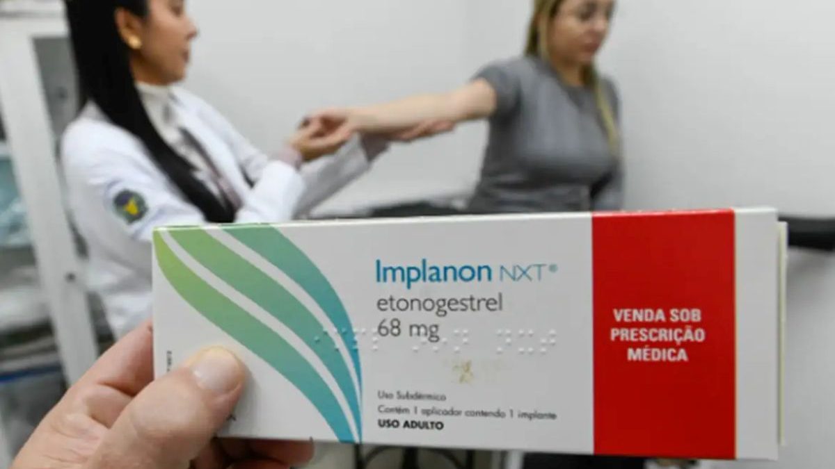 Guarapari começa a disponibilizar implante contraceptivo pelo SUS