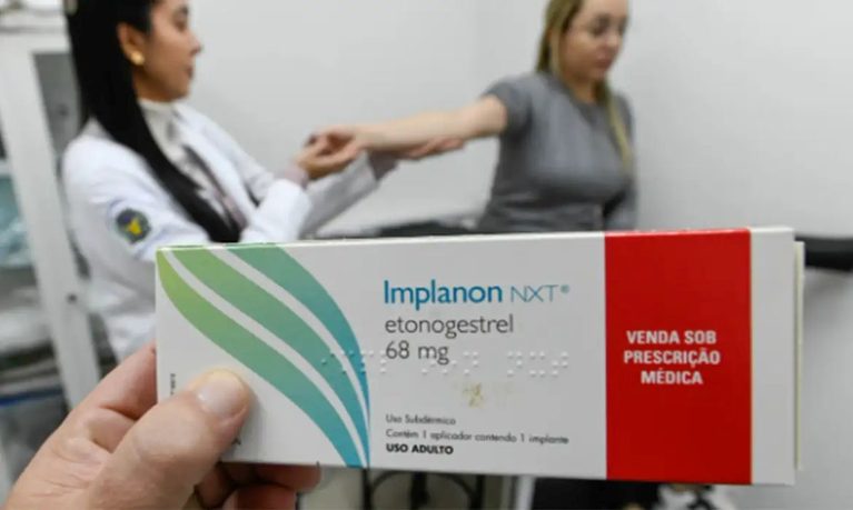 Guarapari começa a disponibilizar implante contraceptivo pelo SUS