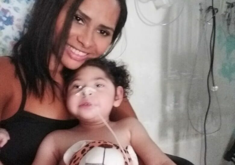 Leite especial microcefalia