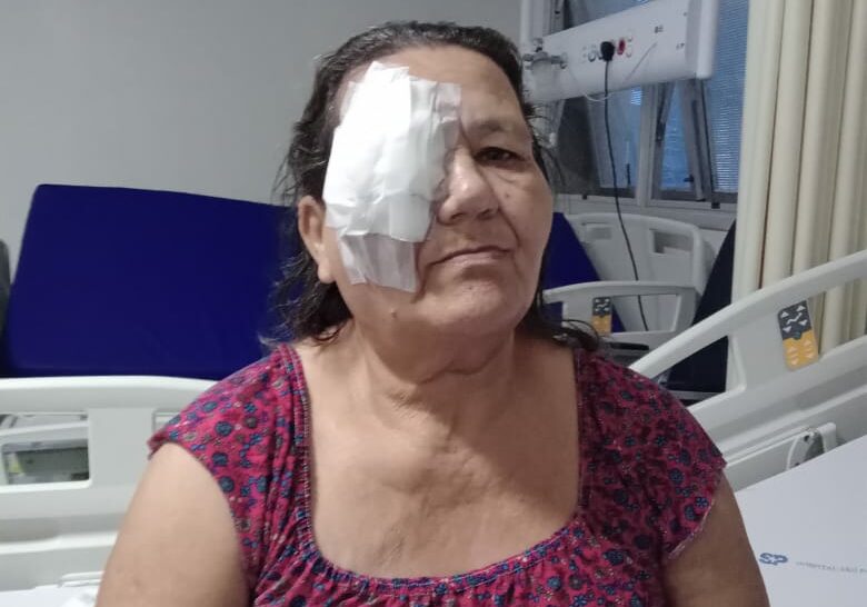 Tumor órbita ocular