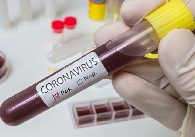 hand-holds-test-tube-for-coronavirus-2019ncov-analysis-picture-id1201511724-760x450 Foto: Reprodução
